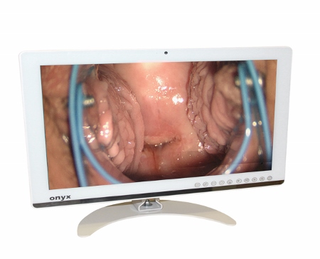 Technology boost for cervical screening in Wales 
