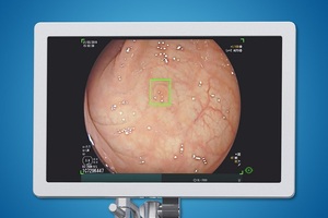 The London Clinic first UK hospital to introduce AI colonoscopy device