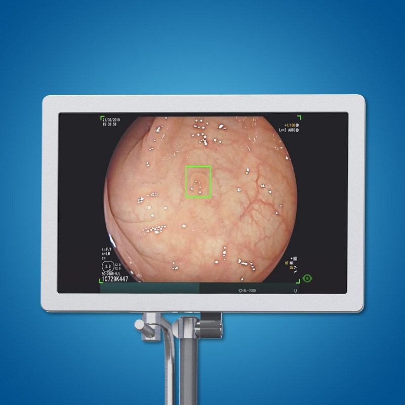 The London Clinic first UK hospital to introduce AI colonoscopy device