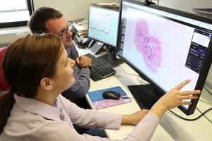 Three NHS Trusts are using AI software for diagnosing prostate cancer