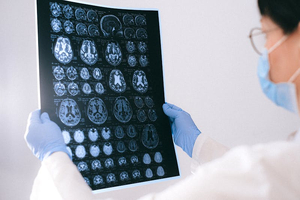 Trust reports on ‘transformative’ tech cuts radiology delays in the NHS