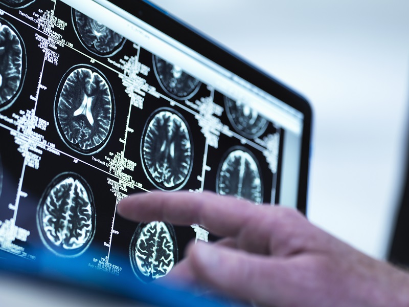 New service models are needed to deliver the expected increase in diagnostic activity needed in the UK, according to an Independent Review of Diagnostic Services for NHS England
