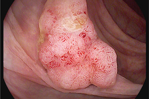 UK endoscopists gather to see latest technology in action