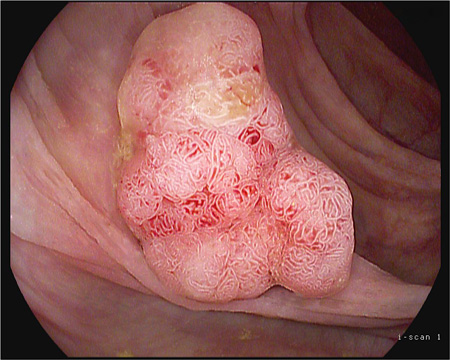 UK endoscopists gather to see latest technology in action