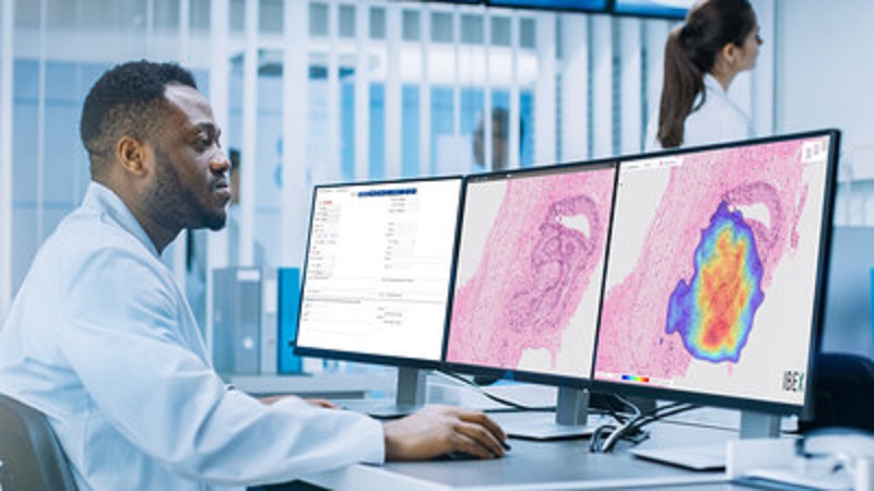 UK's first rollout of AI-based cancer detection for NHS patients