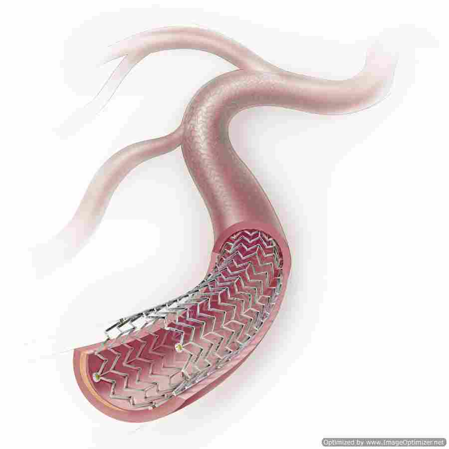 UK surgeons 'slow' to adopt new device that could prevent amputations