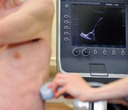Ultrasound system improves pleural services at Cardiff hospital