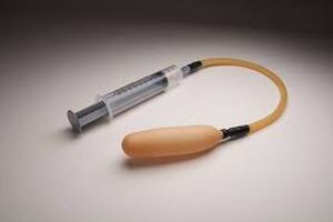 Uterine Balloon Tamponade designed to respond to life-threatening situations in low-resource settings