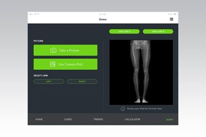 Web app to provide robotic surgery analytics to support new workflows