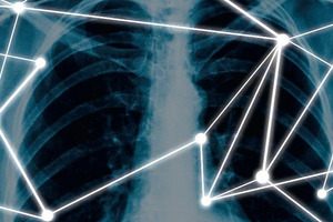 Wellbeing Software and Imbio to offer NHS AI support for lung condition imaging 