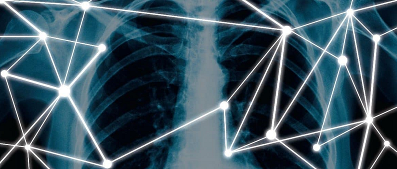 Wellbeing Software and Imbio to offer NHS AI support for lung condition imaging 