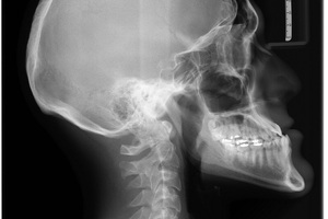 Wellbeing Software and Radiobotics collaborate for AI-powered X-ray assessments