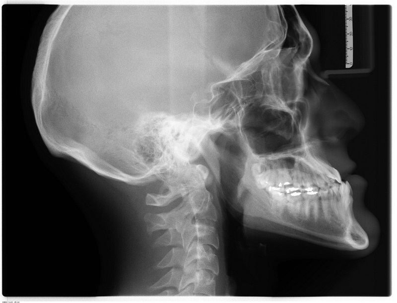 Wellbeing Software and Radiobotics collaborate for AI-powered X-ray assessments