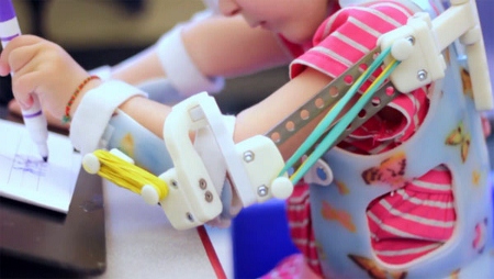 Wheelchair wheel, self-adjustable glasses and robotic arm among world\'s design elite
