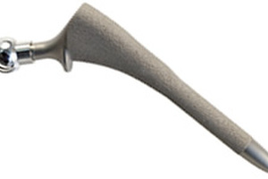 White paper addresses need for tribology and testing of orthopaedic implants